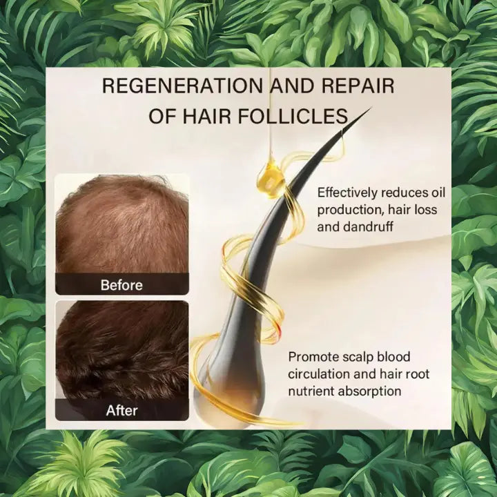 L'huile de ricin pour les cheveux