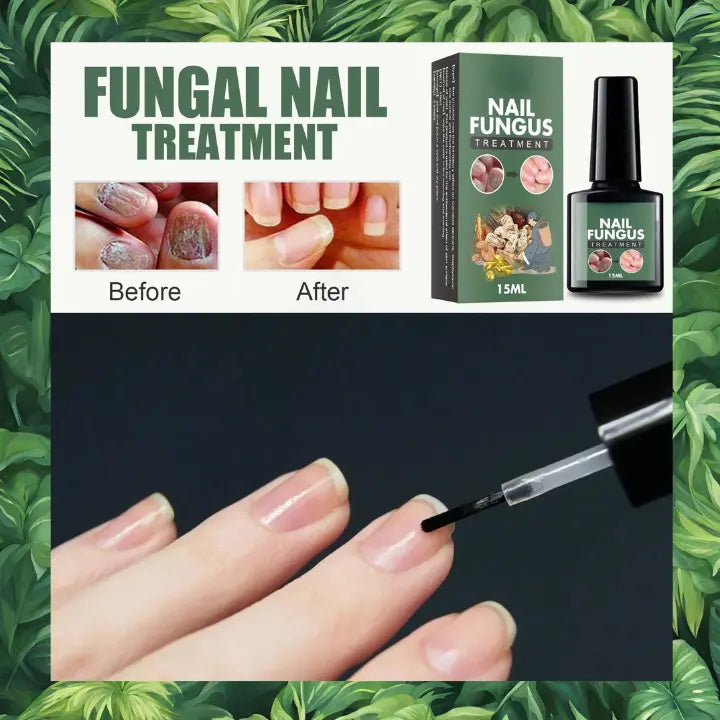 huile essentielle mycose ongle