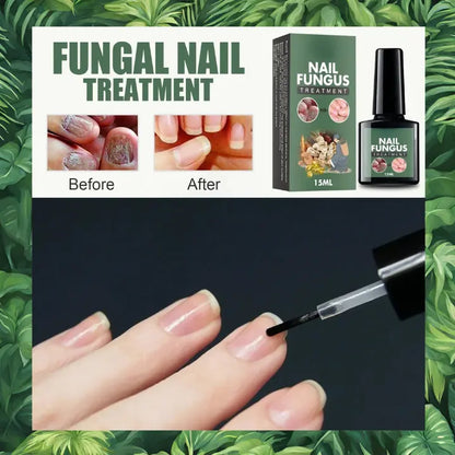 huile essentielle mycose ongle