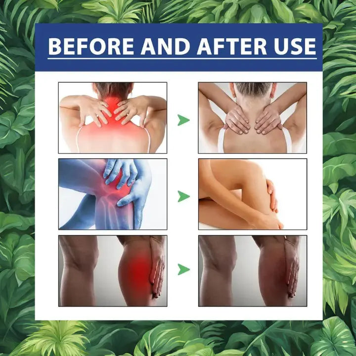 Pommade anti inflammatoire